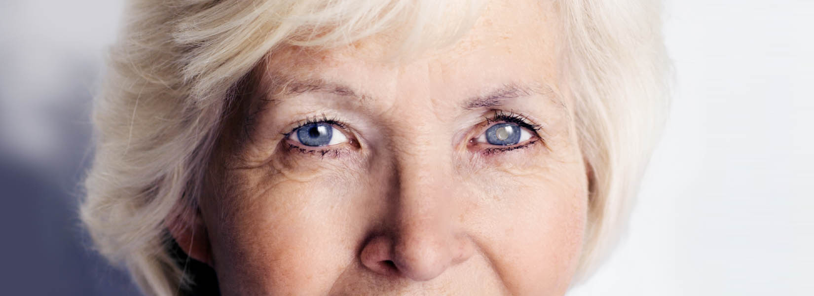 Cataract Surgery in Lakeshore